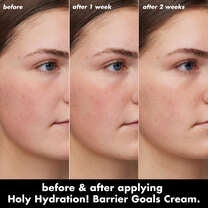 Before and After Using Barrier Goal Cream for Two Weeks